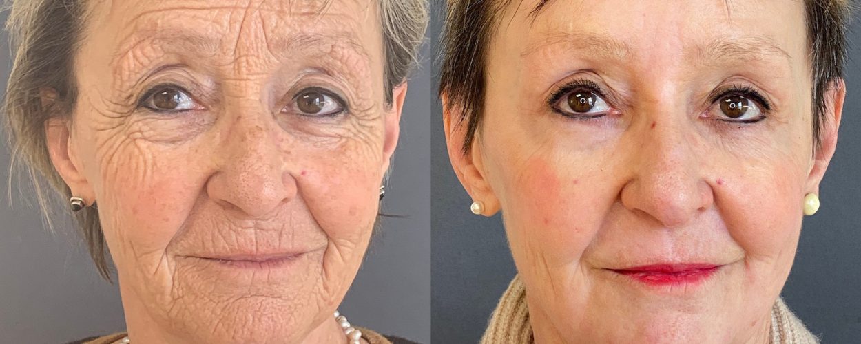 Neues vom Beauty Pro: Porentief nachgefragt